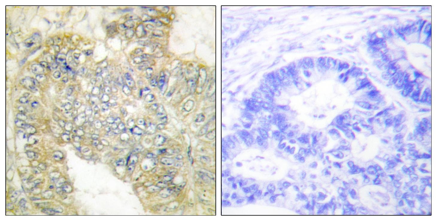 DES / Desmin Antibody (phospho-Ser60)
