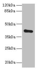 Polyclonal Rabbit anti-Human ZDHHC4 Antibody (IHC, WB)