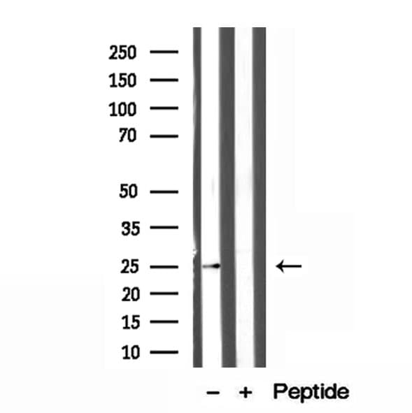 ATP5F1 Antibody