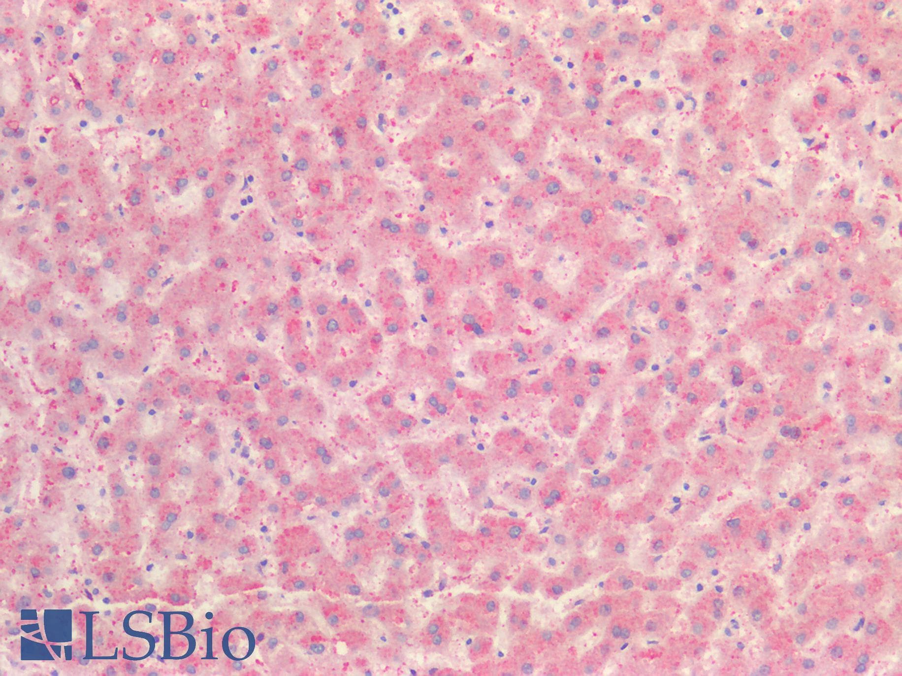 FGL1 / Hepassocin Antibody (aa23-312)