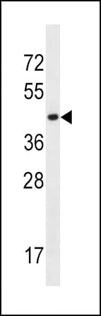 Polyclonal Rabbit anti-Human SLC16A10 Antibody (aa301-329, IHC, WB)