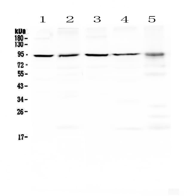 BLIMP1 / PRDM1 Antibody