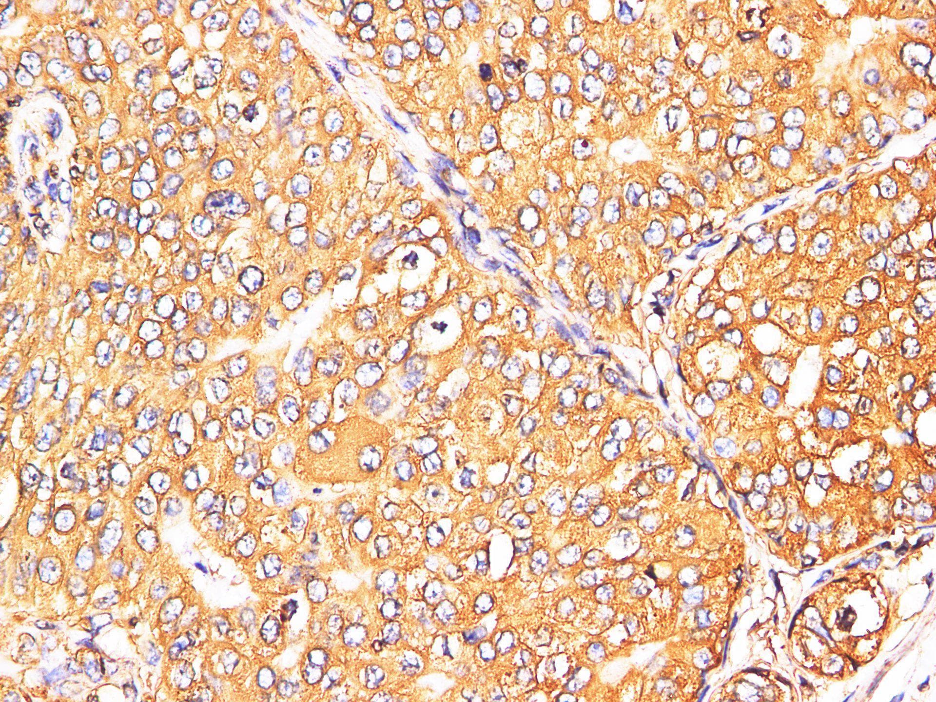 Polyclonal Rabbit anti-Rat S100A9 / MRP14 Antibody (IHC, WB)