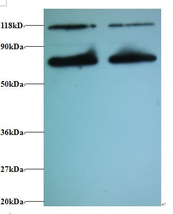 CALR / Calreticulin Antibody (HRP)