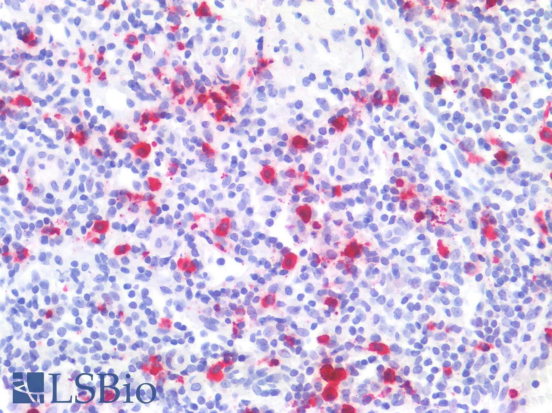 PathPlus™ CTSG / Cathepsin G Antibody (Internal)