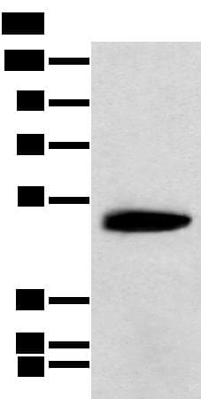 KCTD16 Antibody