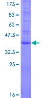 Human AGTRAP / ATRAP Protein (Recombinant GST)