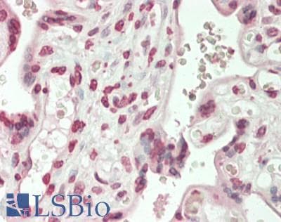 IHC-plus™ Polyclonal Rabbit anti-Human ZIC1+2+3 Antibody (Internal, IHC, IF, WB)
