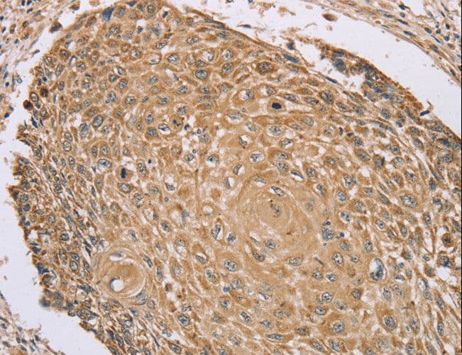 Polyclonal Rabbit anti-Human RNF148 Antibody (IHC)