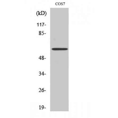PRKAA1 + PRKAA2 Antibody (110-190 aa)