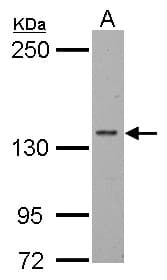 Polyclonal Rabbit anti-Human POLR2B / RPB2 Antibody (aa1-172, IHC, WB)