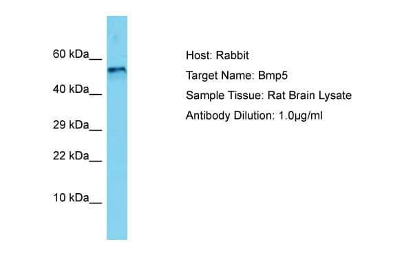 BMP5 Antibody (aa327-376)