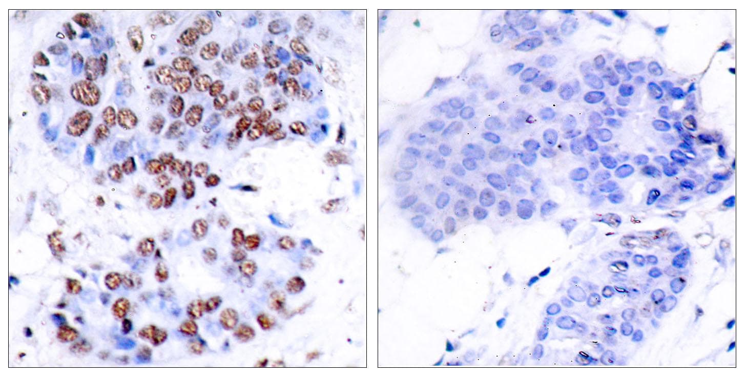 RELA / NFKB p65 Antibody (p276)