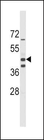 IHC-plus™ Polyclonal Rabbit anti-Human ALDH1A3 Antibody (aa318-348, IHC, WB)