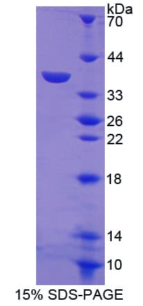 Mouse Metallothionein 1 Protein (Recombinant GST-6His, N-terminus)
