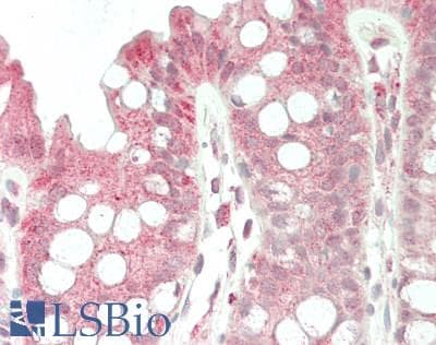 IHC-plus™ INPP5K / SKIP Antibody