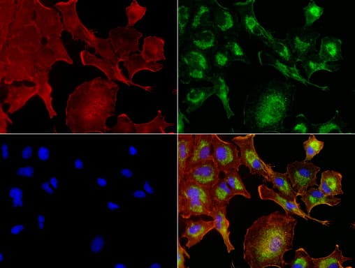 Monoclonal Mouse anti-Human NME1 / NM23 Antibody (clone UMAB92, IHC, IF, WB)