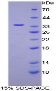 Human RBP3 / IRBP Protein (Recombinant His, N-Terminal)