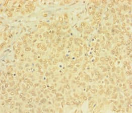 BTG4 Antibody