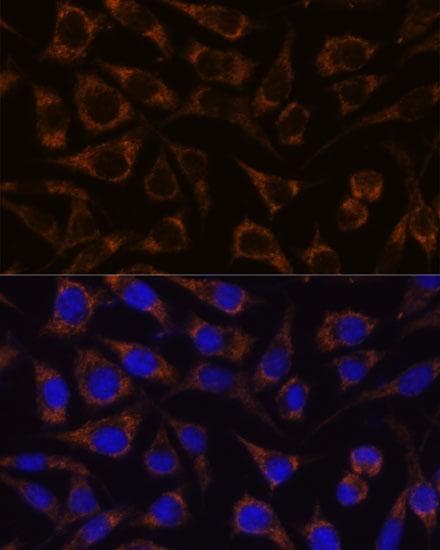 GTPBP8 / HSPC135 Antibody