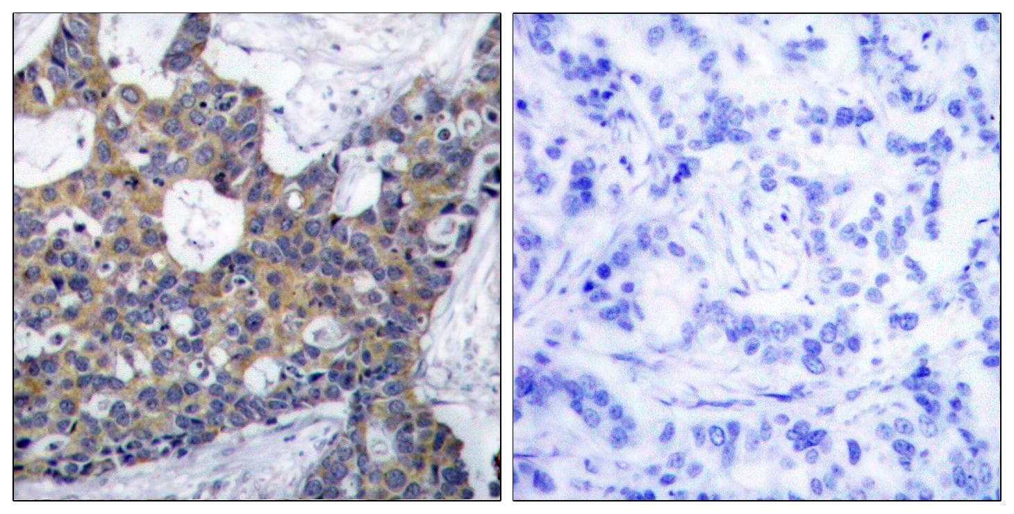 IRS1 Antibody (p639)