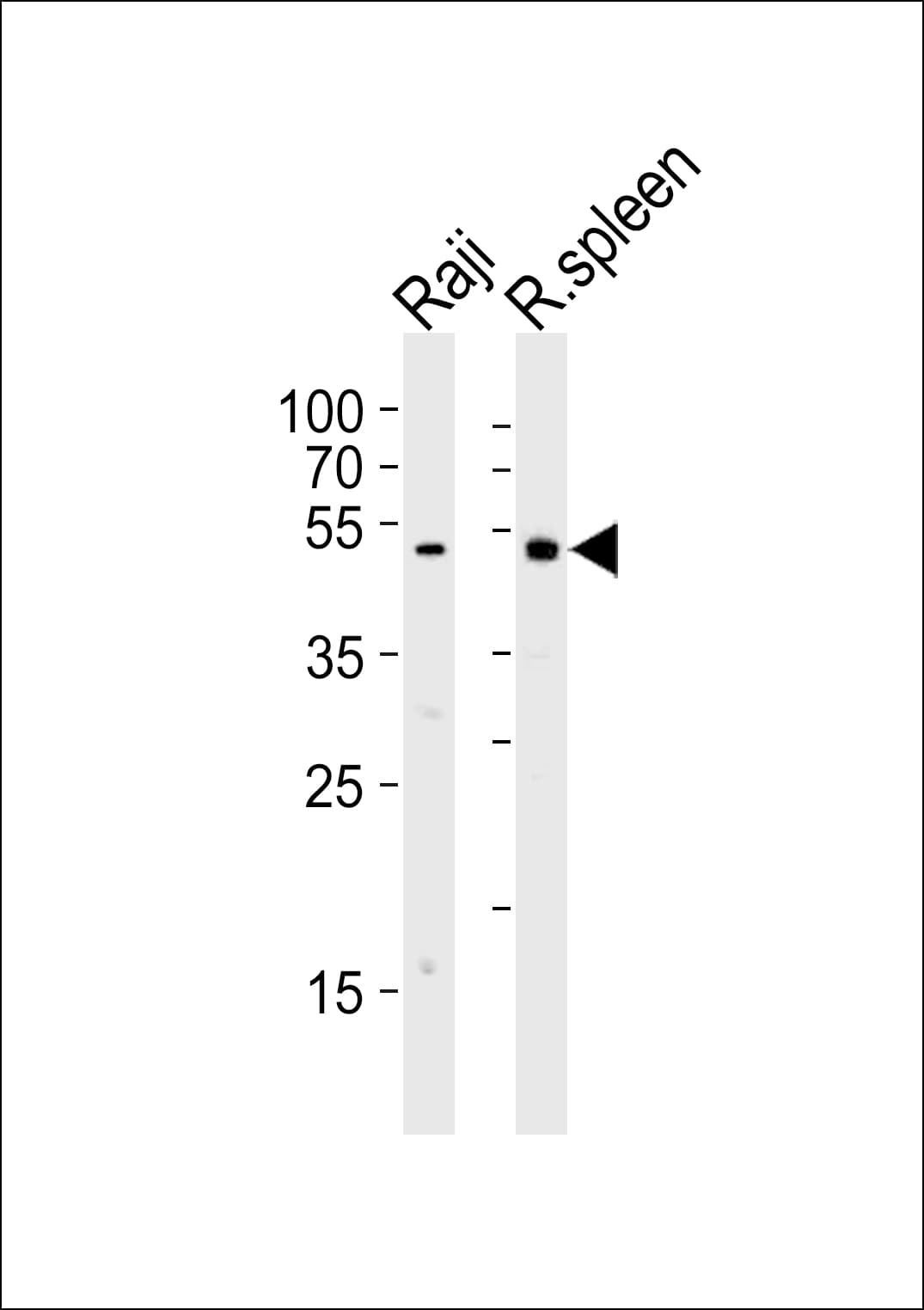 LYN Antibody (aa229-263)