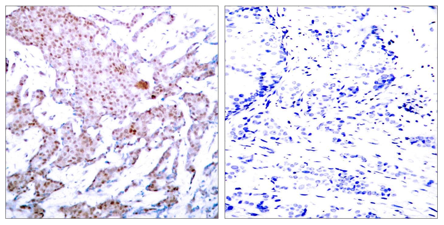 RELA / NFKB p65 Antibody (phospho-Ser536)