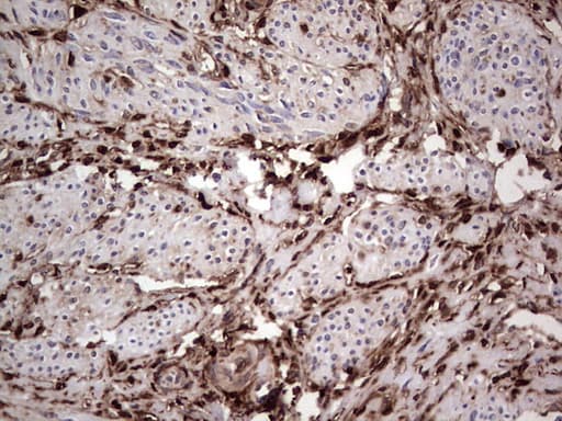Monoclonal Mouse anti-Human LGALS3 / Galectin 3 Antibody (clone OTI15E4, IHC, WB)