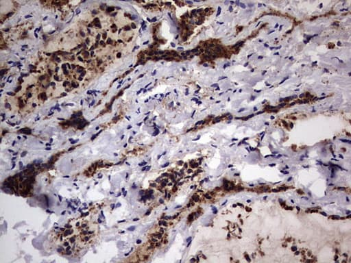 Monoclonal Mouse anti-Human CD63 Antibody (clone OTI5E5, IHC, WB)
