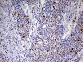 TOP2A / Topoisomerase II Alpha Antibody (aa1100-1531, clone OTI5E6, Carrier-free)