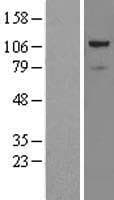 PRPF6 / TOM Protein (Over-Expression Lysate Myc-DDK (Flag))
