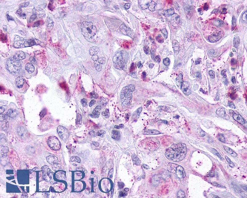 PathPlus™ KISS1R / GPR54 Antibody (Cytoplasmic Domain)