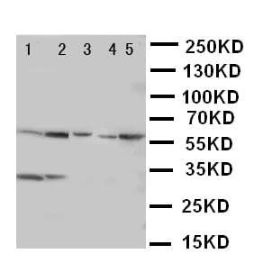 ACCN3 / ASIC3 Antibody (aa56-73)