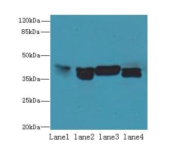 NUDT9 Antibody