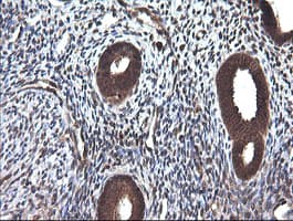 CTAG1B / NY-ESO-1 Antibody (clone OTI5B2)