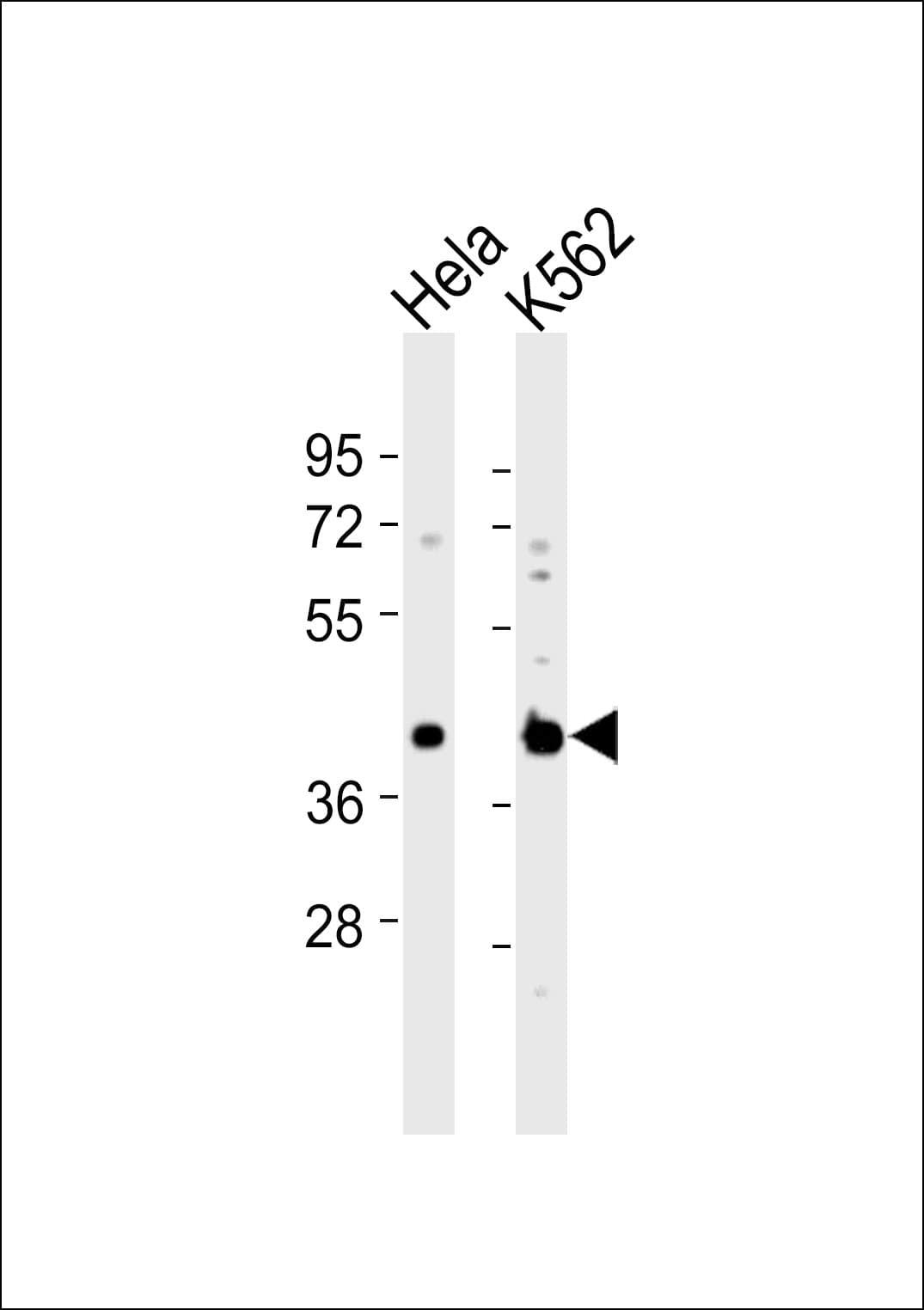 DNAJB11 Antibody
