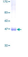 Human ARL4A / ARL4 Protein (Recombinant GST)