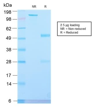 PathPlus™ PLAP / Alkaline Phosphatase Antibody (clone ALPP/2899R)