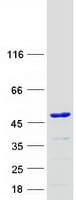 Human KTI12 Protein (Recombinant Myc-DDK (Flag))