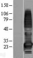 TMEM176A / HCA112 Protein (Over-Expression Lysate Myc-DDK (Flag))