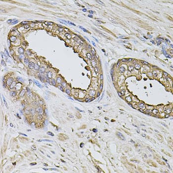 IHC-plus™ Polyclonal Rabbit anti-Human S100A12 Antibody (IHC, WB)