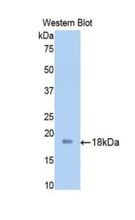 SPTAN1 / Alpha Fodrin Antibody (aa1571-1712, Cy3)
