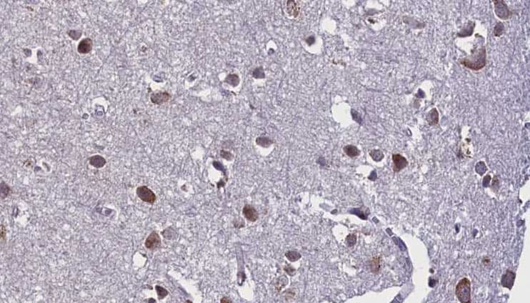 Polyclonal Rabbit anti-Human SNCB / Beta-Synuclein Antibody (IHC, IF, WB)