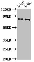 Polyclonal Rabbit anti-Human CAPN1 / Calpain 1 Antibody (IHC, WB)