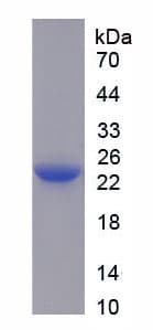 Rat IL6 / Interleukin 6 Protein (Recombinant His)