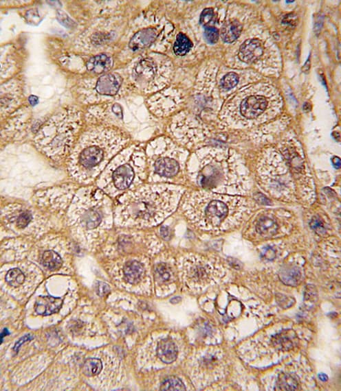 ADRB2 Antibody (Ser261)