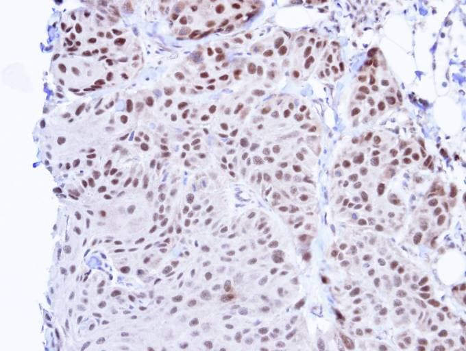 Polyclonal Rabbit anti-Human TBL1XR1 / TBLR1 Antibody (aa210-514, IHC, WB)