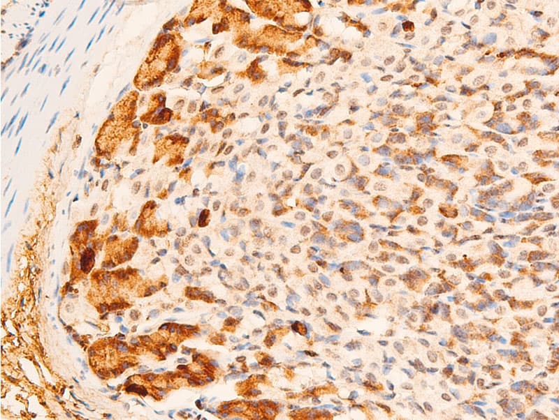 Polyclonal Rabbit anti-Human JUN / c-Jun Antibody (phospho-Tyr170, IHC, WB)
