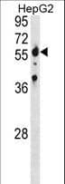 Polyclonal Rabbit anti-Human SPTLC2 / LCB2 Antibody (aa372-401, WB)