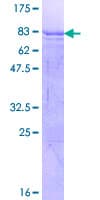 Human SOX8 Protein (Recombinant GST)